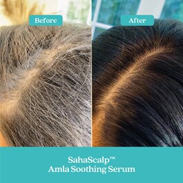 Kopfhaut-Reinigungsset Chevelu SahaScalp™ - Haarpflege-Set
