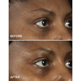 DermInfusions Augenkonturenmaske Lifting + Regeneration