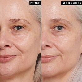 Retinol Pro-Aging Augencreme