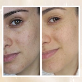 Radiance Overnight Glow Dark Spot Cream