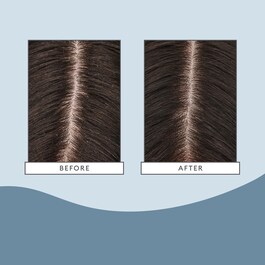 Scalp Revival Charcoal + Tea Tree Cooling Hydration - Scalp Mask
