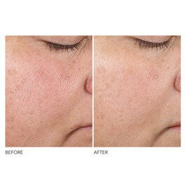 Advanced R + F Texture Renewal - Serum