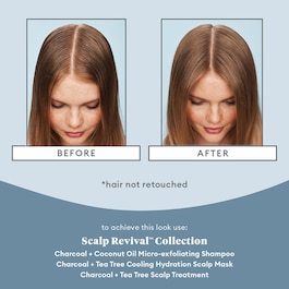 Scalp Revival - Camp Revival Charcoal Tea Tree Scalp