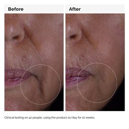 GF 15% Solution - Anti-Aging-Serum