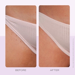 Ingrown Hair Pads - Kompostierbare Pads gegen eingewachsene Haare x60
