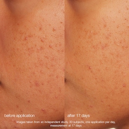 Daily Microfoliant - Mildes enzymatisches und mechanisches Peeling