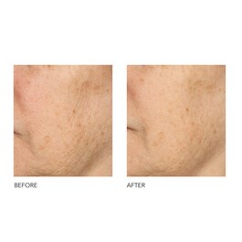 Alpha Beta® Peel Universal Formula