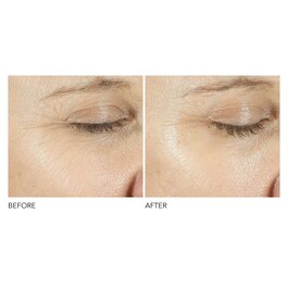 Advanced R + F Triple Correction - Eye Serum
