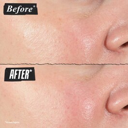 Hydro-Plumping Serum Concentrate - Serum