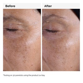 Toner mit 7 % Glykolsäure - Peeling-Lotion