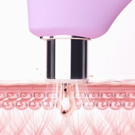 Kiwi™ Derma