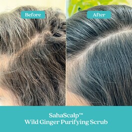 SahaScalp™ - Reinigendes Peeling mit wildem Ingwer