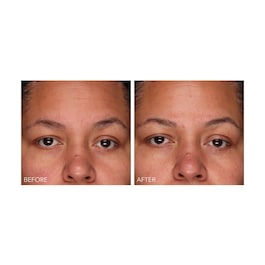 DermInfusions - Gel zur schnellen Regeneration