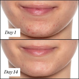 U.F.O. Ultra-Clarifying - Face Oil
