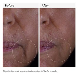 GF 15% Solution - Anti-Aging-Serum