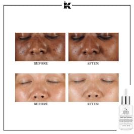 Clearly Corrective - Dark Spot Solution
