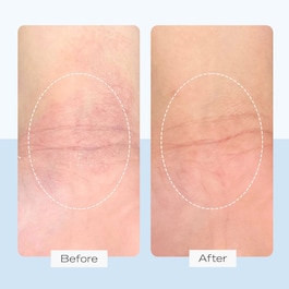 Ultra Repair Cream - Intensive Feuchtigkeitscreme für Gesicht und Körper