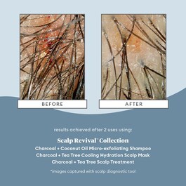 Scalp Revival - Micro Exfoliating Shampoo