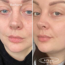 Rosehip BioRegenerate Oil