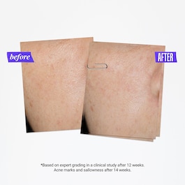 Clearly Corrective - Dark Spot Solution