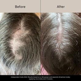 Pitta Growth Serum - Wachstumsserum
