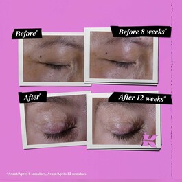 Super Multi Eye Zone Treatment - Anti-Aging Augencreme