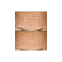 Vitamin C + Lactic - Serum mit 15% Vitamin C Straffung und Strahlkraft
