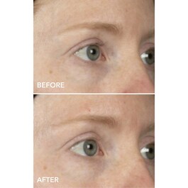 DermInfusions Augenkonturenmaske Lifting + Regeneration