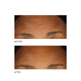 Alpha Beta® - Peel Extra Strength