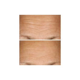 Vitamin C + Lactic - Serum mit 15% Vitamin C Straffung und Strahlkraft