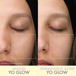 Gesichtsscrub - Yo Glow