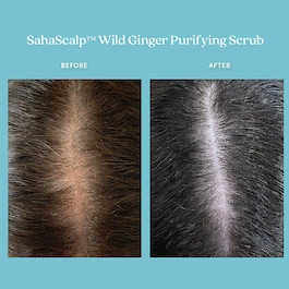 SahaScalp™ - Reinigendes Peeling mit wildem Ingwer