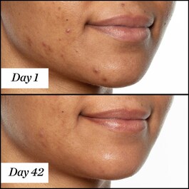 U.F.O. Ultra-Clarifying - Face Oil