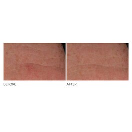 Advanced R + F Overnight Wrinkle - Treatment
