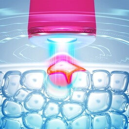 ESPADA™ 2 - mit LED-Blauchlicht zur Behandlung von Hautunreinheiten 