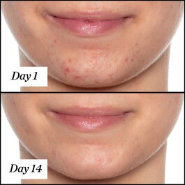 U.F.O. Ultra-Clarifying - Face Oil