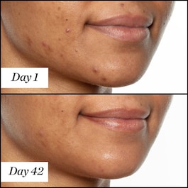 U.F.O. Ultra-Clarifying - Face Oil