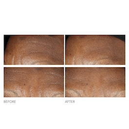 Advanced Retinol + Ferulic - Intensive Anti-Falten-Creme