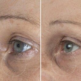 The Eye Cream Nomad - Die Nomad Augencreme