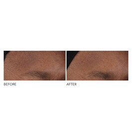 Advanced R + F Overnight Wrinkle - Treatment
