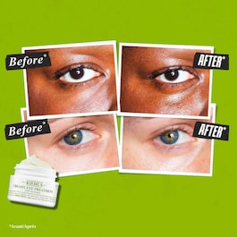 Creamy Eye Treatment With Avocado - Augencreme