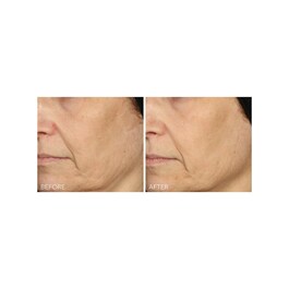 Vitamin C + Lactic - Serum mit 15% Vitamin C Straffung und Strahlkraft