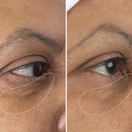 The Eye Cream - Die Augencreme