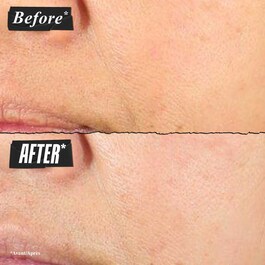 Super Multi-Corrective Cream - Feuchtigkeitscreme