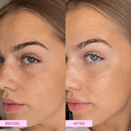 Australian Emu Apple - Dreamy Glow Drops Serum
