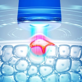 ESPADA™ - Akne-Therapiegerät mit LED-Blauchlicht