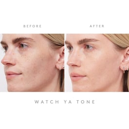 Watch Ya Tone - Serum gegen Pigmentflecken