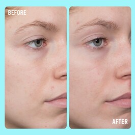 10% Vitamin C Brightening Serum - Aufhellendes Serum mit 10% Vitamin C 