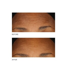 Alpha Beta® - Peel Extra Strength