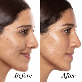 A+ hochkonzentriertes Serum mit Retinoiden